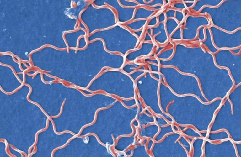 Scanning electron microscopic 